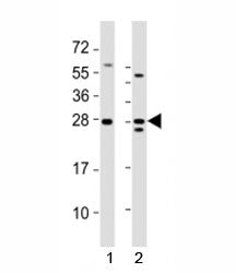 Western blot testing of Lin28a antibody at 1:2000 dilution. Lane 1: mouse F9 lysate; 2: human NCCIT