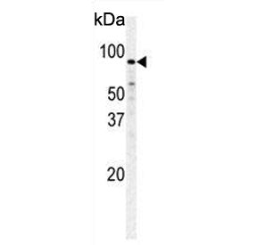 Fructose 6 Phosphate Kinase Antibody / PFKM