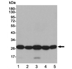 Western blot testing of human 1) HeLa, 2) THP-1, 3) A549, 4) Ramos and 5) K562 cell lysates using SO