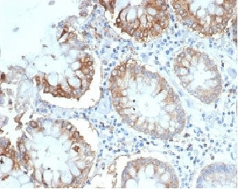CD2 Antibody