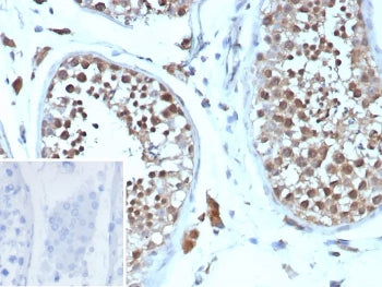 Cyclin B1 Antibody / CCNB1