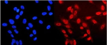Neurofibromin Antibody / NF1