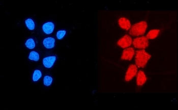 NDUFB5 Antibody