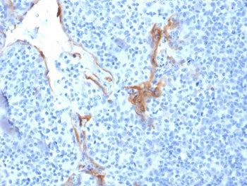 KRT16 Antibody / Cytokeratin 16