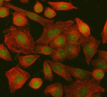 Immunofluorescent staining of FFPE human SiHa cells with ING5 antibody (green) and Beta Tubulin mAb