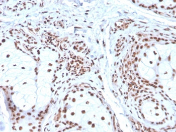 Nucleophosmin Antibody / NPM1