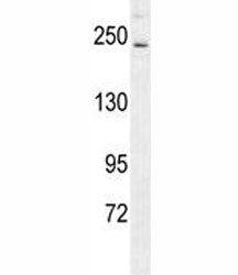 RICTOR Antibody