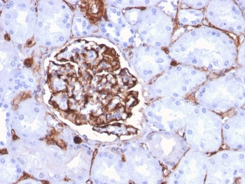 IHC staining of FFPE human kidney with Nestin antibody (clone NES/2911). HIER: boil tissue sections