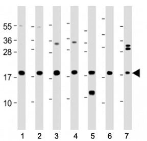 ARPC5 / p16 ARC Antibody (Center Region)