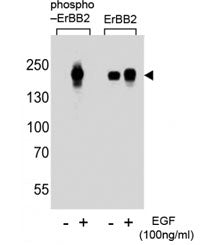 Western blot analysis of extracts from A431 cells, untreated or treated with EGF at 100ng/ml, using