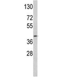 ACADM Antibody