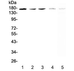 IRE1 Antibody