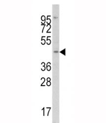 IRF8 Antibody