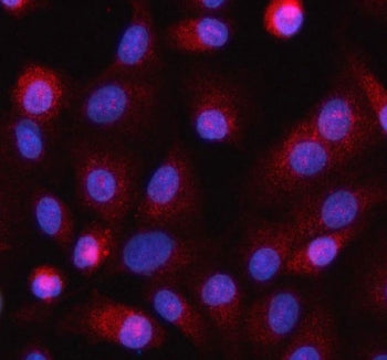 Immunofluorescent staining of FFPE human A549 cells with HELZ antibody (red) and DAPI nuclear stain