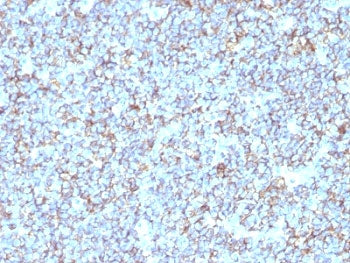 CD99 Antibody