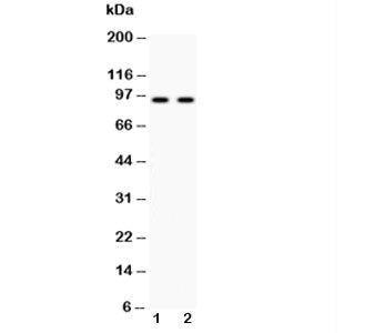 Western blot testing of Cadherin 17 antibody and 1) human HeLa and 2) human SW620 cell lysate. Predi
