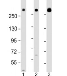 Western blot testing of human 1) 293T/17, 2) HeLa and 3) Jurkat cell lysate with IGF2R antibody at 1