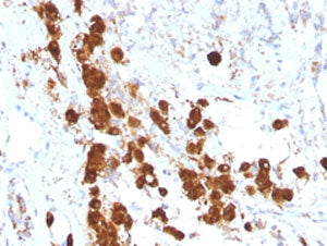Synacthen Antibody / ACTH