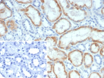 IHC staining of FFPE human kidney tissue with Mineralocorticoid Receptor antibody (clone NR3C2/4900)