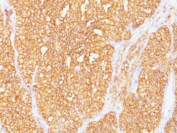 CA9 Antibody / Carbonic Anhydrase IX