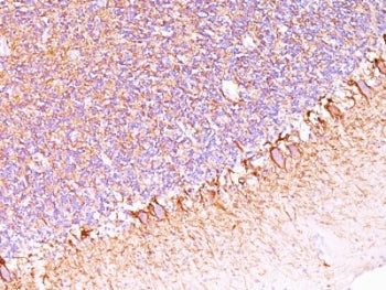 Neurofilament Antibody (-Heavy) / NF-H / NEFH