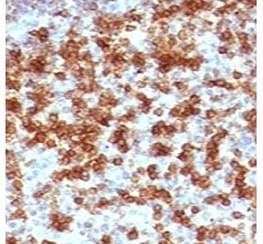 IHC testing of FFPE human tonsil stained with anti-PD-1 antibody (clone PD203-1). FFPE testing requi