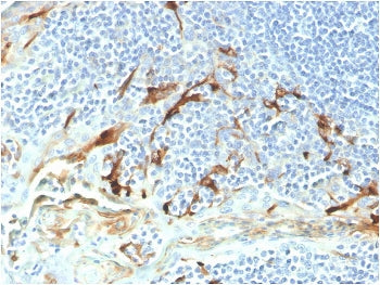 Mesothelin Antibody / MSLN