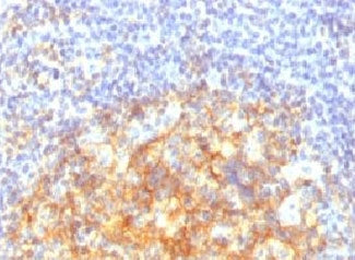 VCAM-1 Antibody