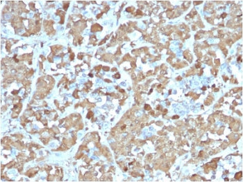 Growth Hormone Antibody / GH1