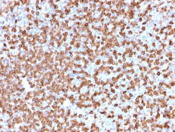 CD74 / CLIP Antibody