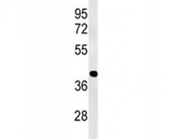 ATF1 Antibody