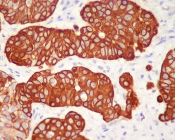 Cytokeratin 5 Antibody / KRT5 (C-Terminal)