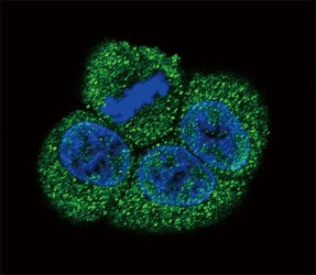 VEGFR2 Antibody (FLK1, KDR)
