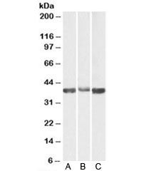 ALDOA Antibody