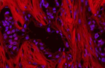 p62 Antibody / SQSTM1