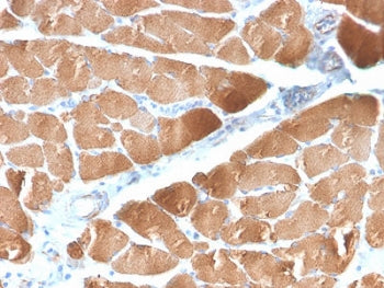 IHC testing of FFPE human skeletal muscle with recombinant Desmin antibody (clone DES/2960R). Requir