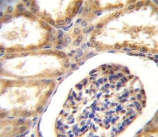 DDR1 Antibody