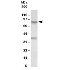 Western blot testing of A549 lysate with VAP-1 antibody at 0.1ug/ml. Predicted molecular weight ~85