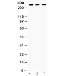Western blot testing of human 1) HeLa, 2) A431 and 3) A549 cell lysate with PTPRF antibody. Observed