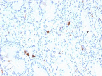 Gastrin Antibody