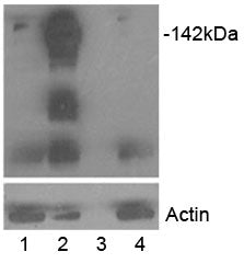 Tankyrase Antibody
