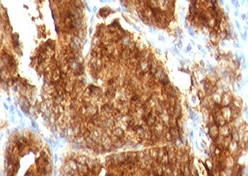 AMACR / p504S Antibody (Prostate Cancer Marker)