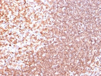 IHC analysis of formalin-fixed, paraffin-embedded human tonsil stained with anti-CD74 antibody (clon