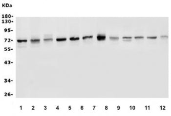Western blot testing of 1) human HeLa, 2) human MCF7, 3) human A375, 4) human T-47D, 5) human A549,