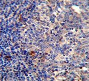 Bcl10 Antibody