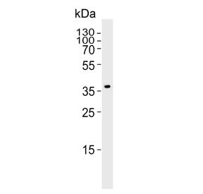 Western blot testing of rat kidney tissue lysate with Pdgfd antibody. Predicted molecular weight ~43
