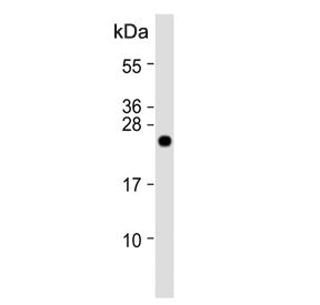 Claudin 2 Antibody / CLDN2