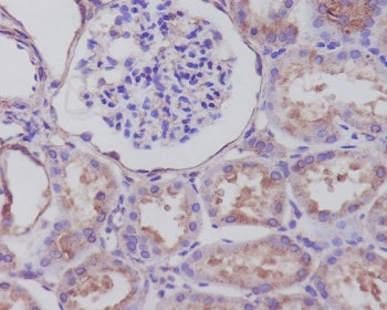IHC staining of FFPE human kidney tissue with SYP antibody. HIER: boil tissue sections in pH6, 10mM