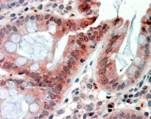 FIZZ1 Antibody
