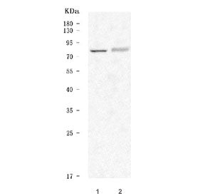 Western blot testing of 1) rat brain and 2) rat C6 cell lysate with 5-HT2C Receptor antibody. Predic